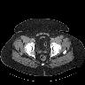 image 415