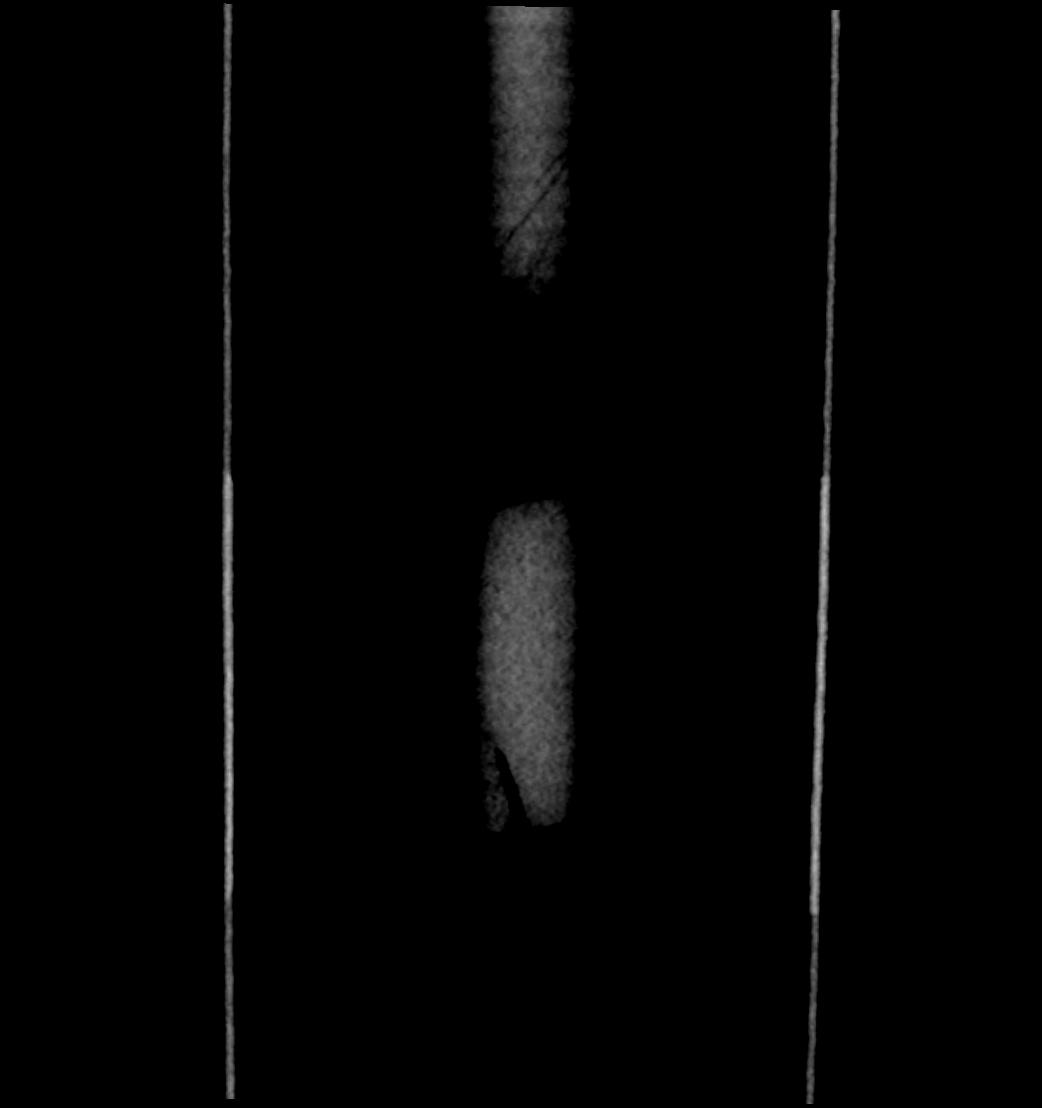 image 118