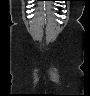 image 100