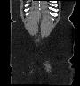 image 101