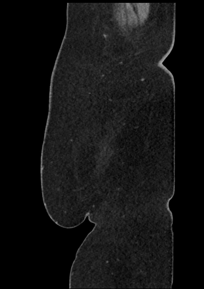 image 142