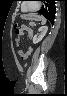 image 100